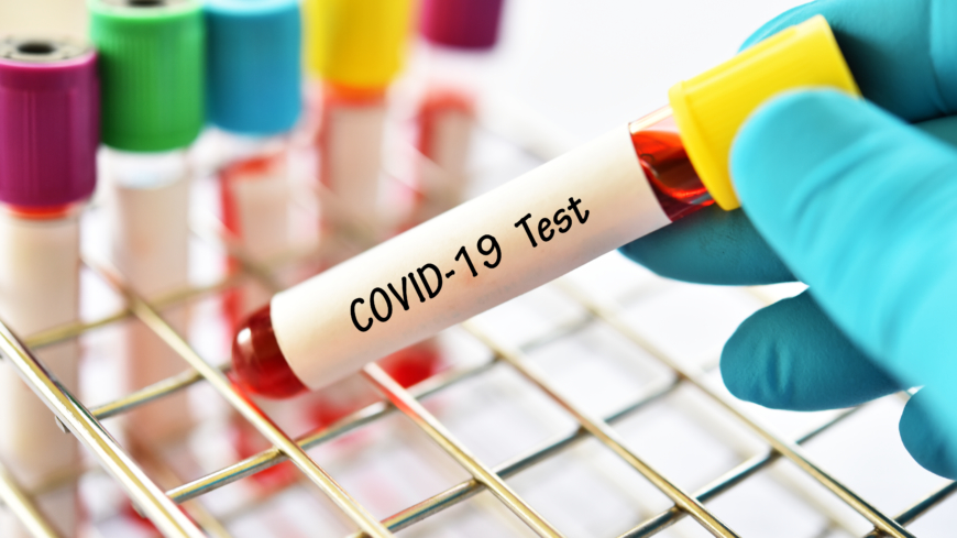 För att skydda vårdpersonal och riskgrupper är det viktigt att kunna testa för coronavirus. Testar man även befolkningen för att se hur långt vi har kommit när det gäller flockimmunitet, skulle det underlätta för att kunna få tillbaka ett normalt fungerande samhälle igen. Foto: Shutterstock